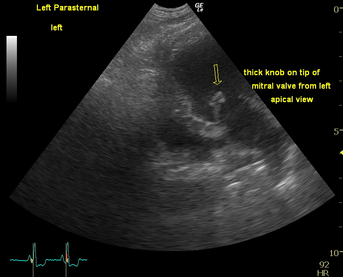 ultrasound ultrasound