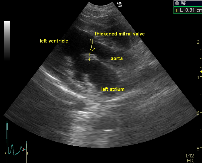 ultrasound ultrasound