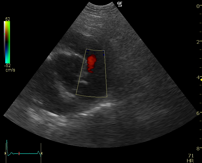 ultrasound ultrasound